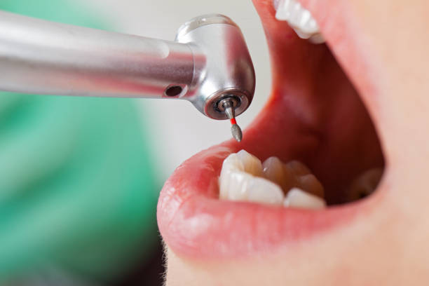 Best Dental Abscess Treatment in Willoughby Hills, OH